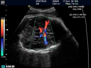 Imagen sobre "Ecografía Morfológica + Doppler"