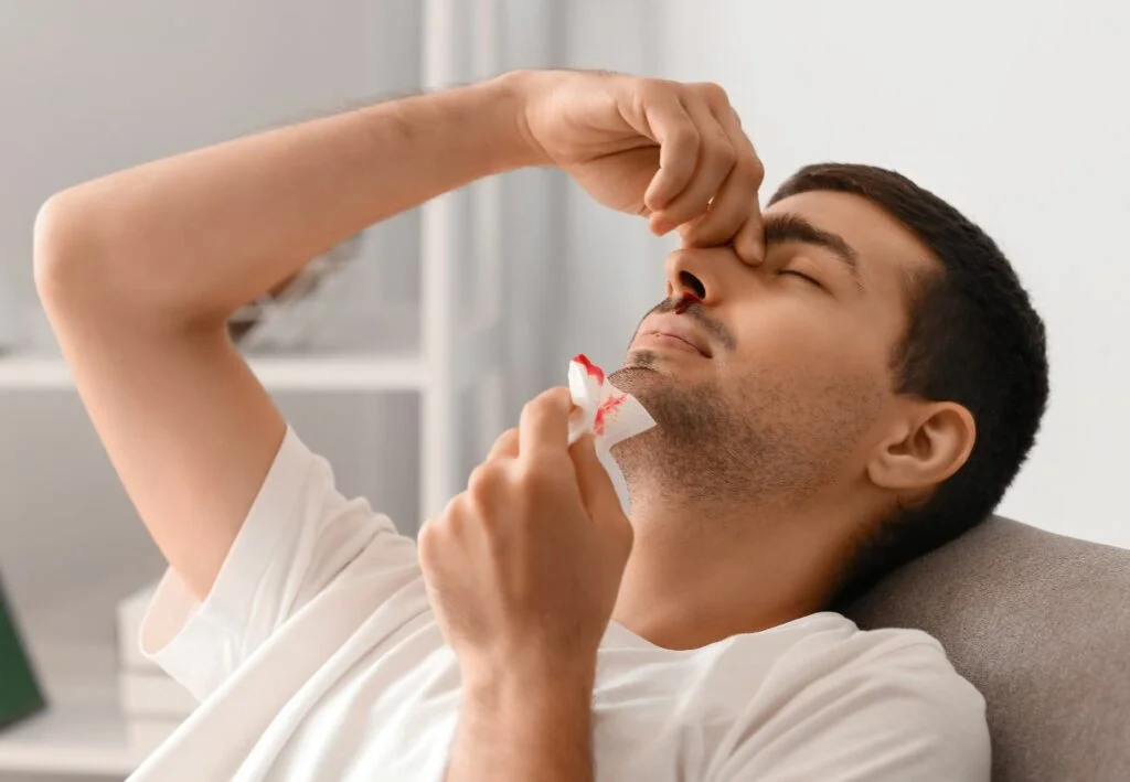 Imagen sobre "Sangrado nasal (epistaxis)"