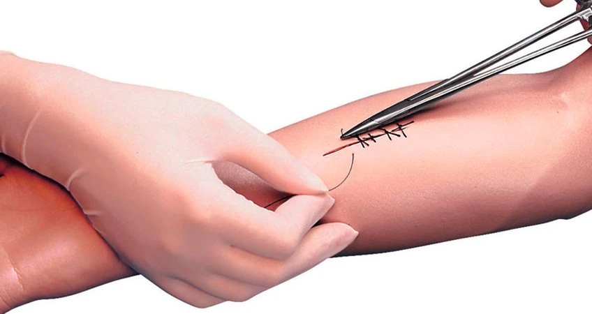 Imagen sobre "Retiro de Puntos"